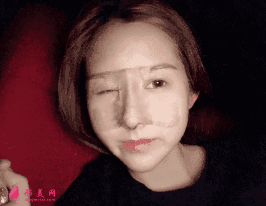 成都蜀尚蓉雅美容整形口碑怎么樣？附醫(yī)院介紹+隆鼻案例分享