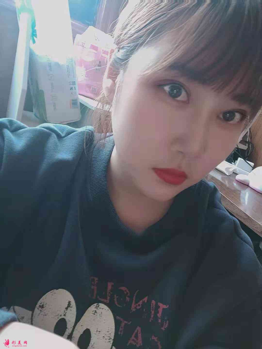 無(wú)錫同濟(jì)醫(yī)療整形美容醫(yī)院怎么樣？附雙眼皮術(shù)后效果對(duì)比及2021價(jià)格表