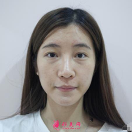 九江整形醫(yī)院那些好？星瑞美、圣嘉麗口碑領(lǐng)銜_除皺案例分享