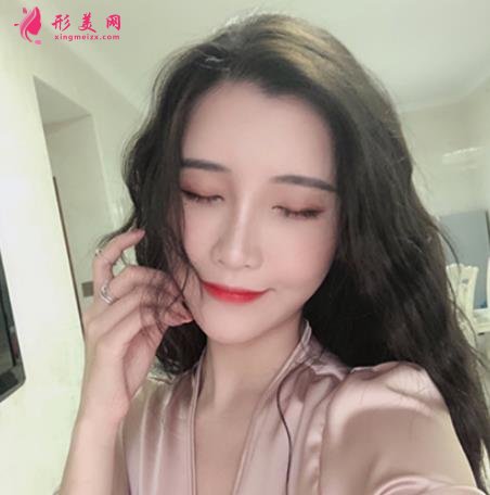 九江整形醫(yī)院那些好？星瑞美、圣嘉麗口碑領(lǐng)銜_除皺案例分享