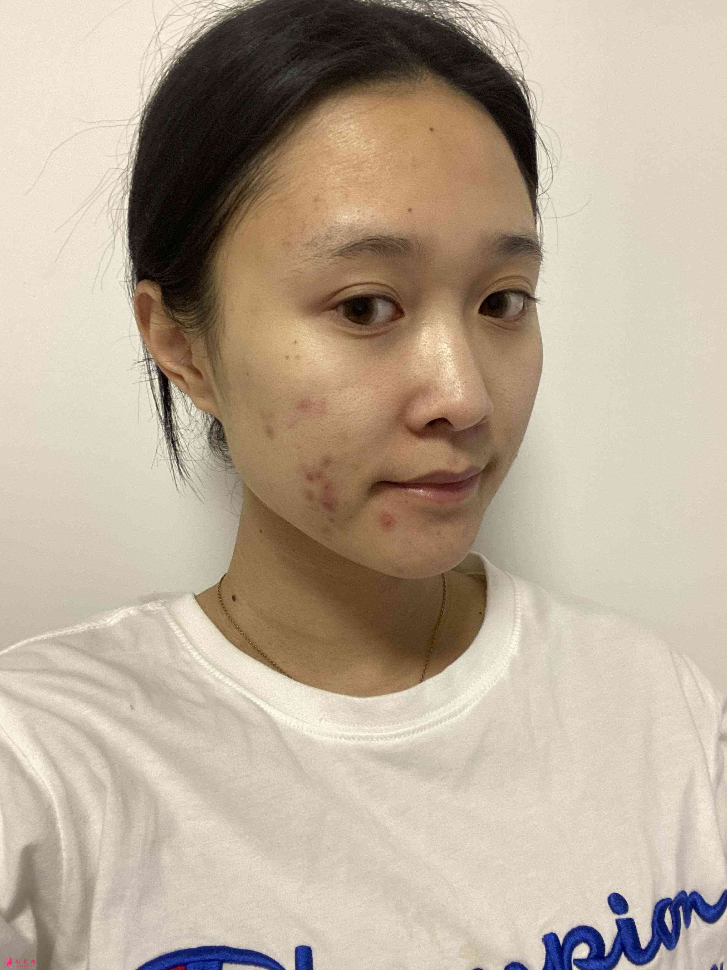 重慶當代整形美容醫(yī)院怎樣?2021價格表發(fā)布+下頜角術(shù)后效果對比 重慶當代整形美容醫(yī)院怎樣?2021價格表發(fā)布+下頜角術(shù)后效果對比