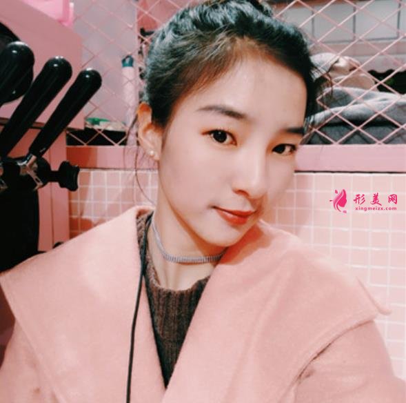 武漢同濟(jì)醫(yī)院整形科（公立）價(jià)格收費(fèi)標(biāo)準(zhǔn)更新！隆鼻案例全面公開~