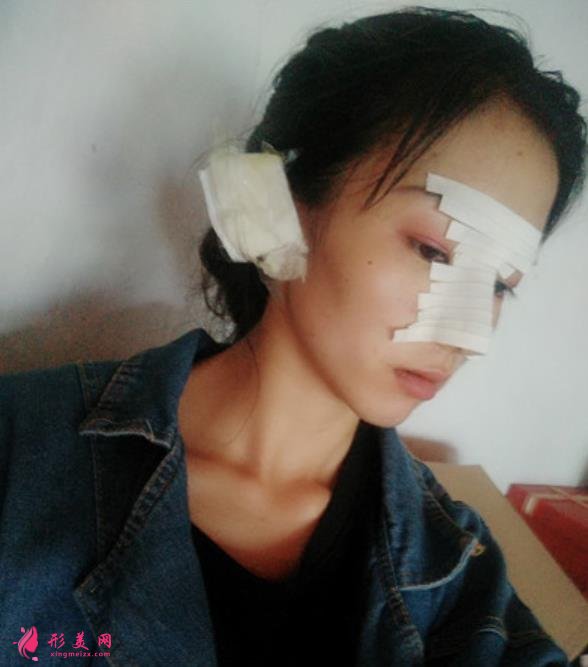 武漢同濟(jì)醫(yī)院整形科（公立）價(jià)格收費(fèi)標(biāo)準(zhǔn)更新！隆鼻案例全面公開~