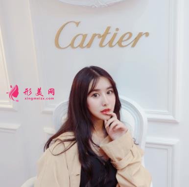 北京煤醫(yī)整形醫(yī)院做面部吸脂瘦臉怎么樣？看完案例效果圖你肯定心動(dòng)~~