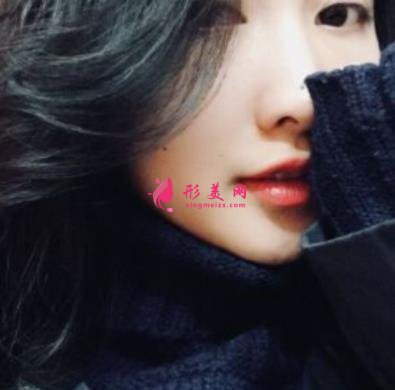 重慶星榮整形外科醫(yī)院整形外科自體脂肪全臉填充案例+價(jià)格表提前一覽