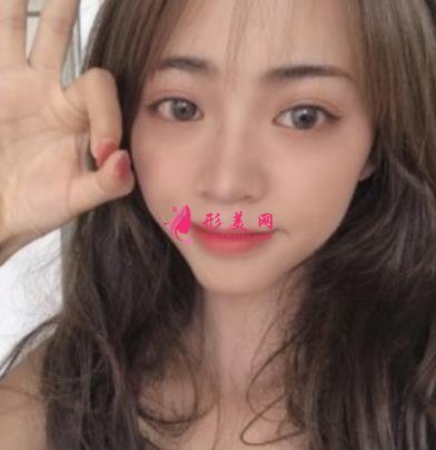 重慶星榮整形外科醫(yī)院整形外科自體脂肪全臉填充案例+價(jià)格表提前一覽