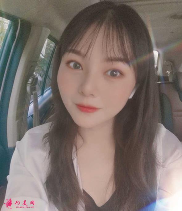 廣東省第二人民醫(yī)院整形美容科做隆鼻怎么樣？看專家案例價(jià)格查詢