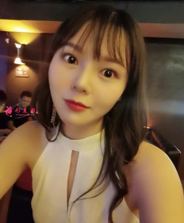 廣東省第二人民醫(yī)院整形美容科做隆鼻怎么樣？看專家案例價(jià)格查詢