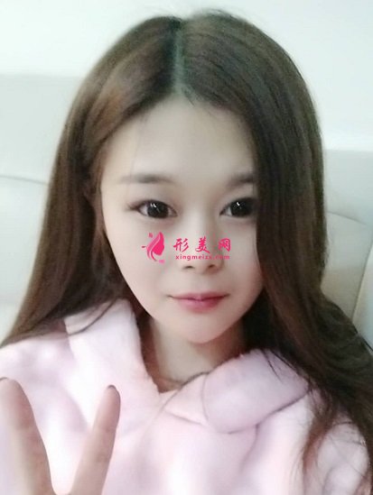 誰讓穆寶安做過面部拉皮提升的？分享下北京加減美手術案例及價目表2021