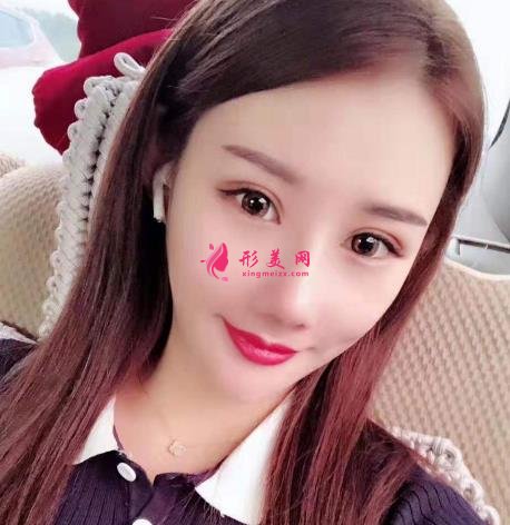 上海有名氣隆鼻醫(yī)生牛永敢做鼻子多少錢?價格收費標準及真實案例反饋