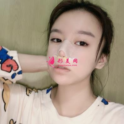 蘇州昆山百達(dá)麗醫(yī)療美容靠譜嗎？做鼻子真實(shí)案例及價(jià)目表_口碑介紹