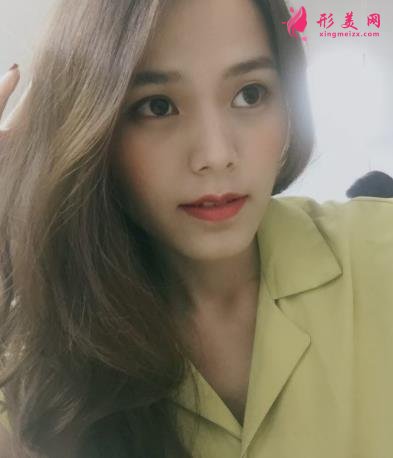 福州海峽美容醫(yī)院去眼袋怎么樣？技術(shù)特色、案例、價格收費雙雙公開