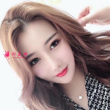 上海有名氣隆鼻醫(yī)生牛永敢做鼻子多少錢?價格收費標(biāo)準(zhǔn)及真實案例反饋