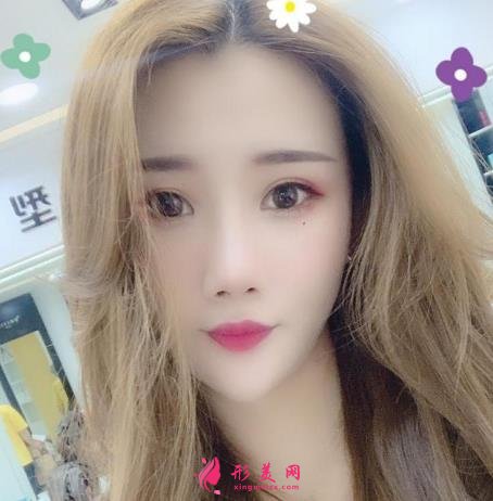 上海有名氣隆鼻醫(yī)生牛永敢做鼻子多少錢?價格收費標(biāo)準(zhǔn)及真實案例反饋