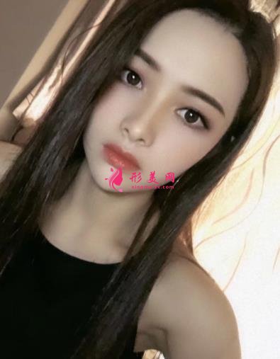 寧波壹加壹整形醫(yī)院怎么樣？從簡介及激光去眼袋案例、價格收費(fèi)可以看出