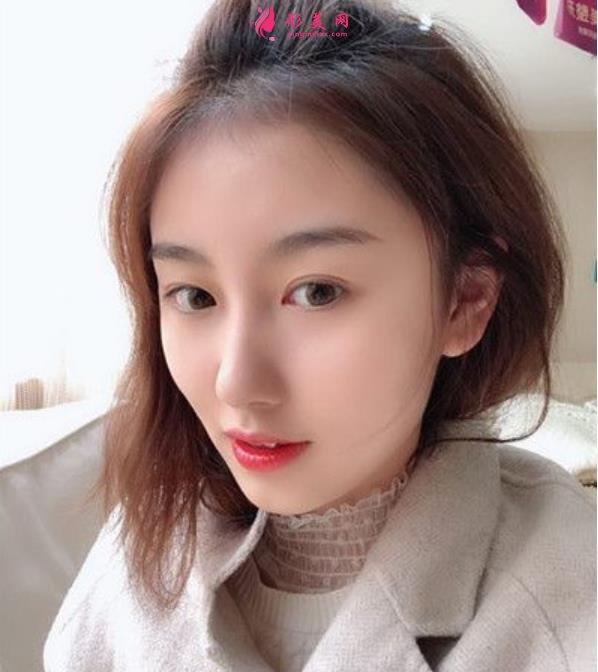 湘雅醫(yī)院鼻綜合手術(shù)案例分享!鼻孔縮小術(shù)你了解多少？