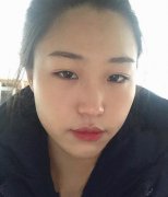 淮安市第一人民醫(yī)院整形科怎么樣?瘦臉針案例+價格價目表分享