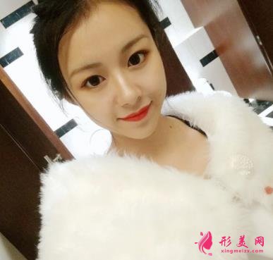 廣州曙光醫(yī)院做雙眼皮手術(shù)怎么樣？多少錢？眼整形案例及費用價格查詢