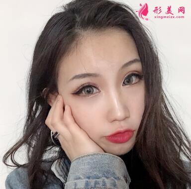 成都八大處整形醫(yī)院隆鼻案例曝光！還有價(jià)格收費(fèi)明細(xì)參考