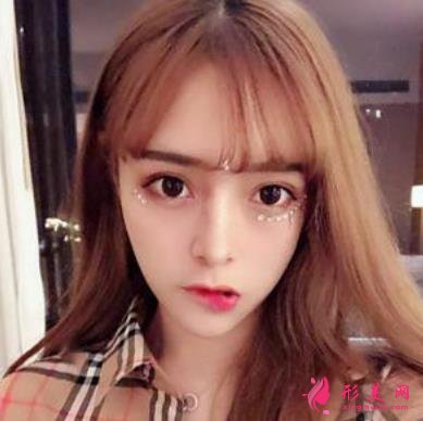 臺州恩澤醫(yī)院整形科隆鼻怎么樣？2021價格價目表+案例恢復(fù)日記分享