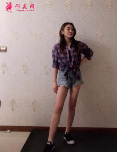 溫州醫(yī)科大學(xué)附屬第二醫(yī)院整形科吸脂怎么樣？價格及案例分享