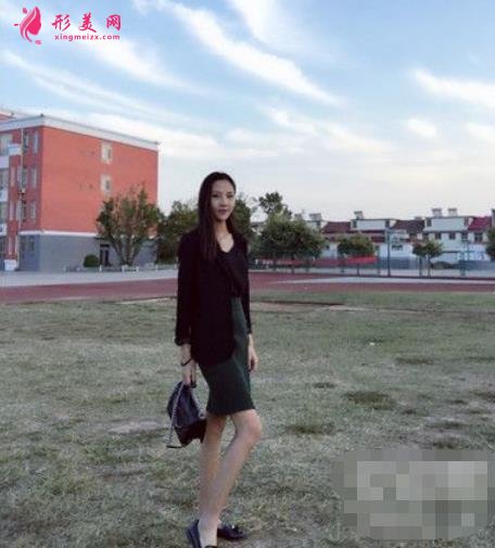 第四軍醫(yī)大學(xué)西京醫(yī)院整形科吸脂效果咋樣？案例價(jià)格收費(fèi)表一覽