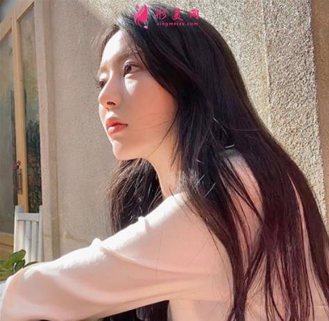 北醫(yī)三院整形科下頜角磨骨案例日記分享!還有價(jià)格收費(fèi)表明細(xì)供參考