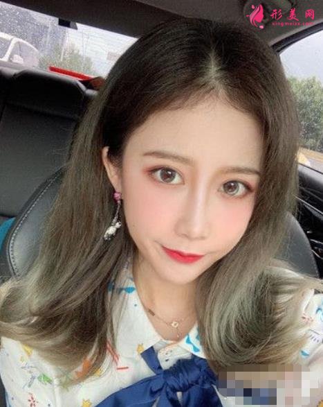 山大二院何茂文醫(yī)生做的雙眼皮咋樣?案例效果價(jià)格收費(fèi)表公開(kāi)