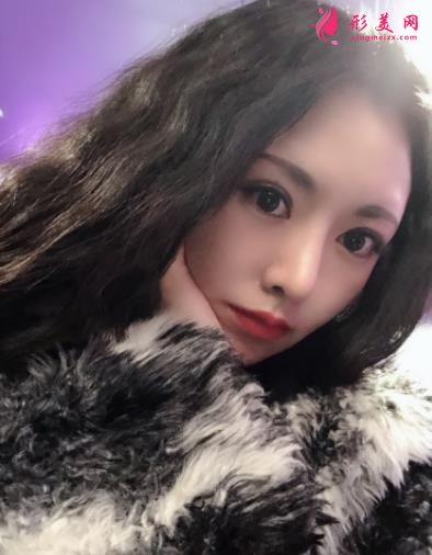 成都新麗美整形醫(yī)院隆鼻怎么樣？口碑案例和正規(guī)費(fèi)用（價(jià)格表）一覽