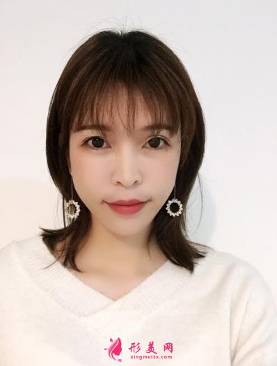 北京協(xié)和醫(yī)院脂肪填充做得好嗎？王陽醫(yī)生案例和價(jià)格表紛紛上線！