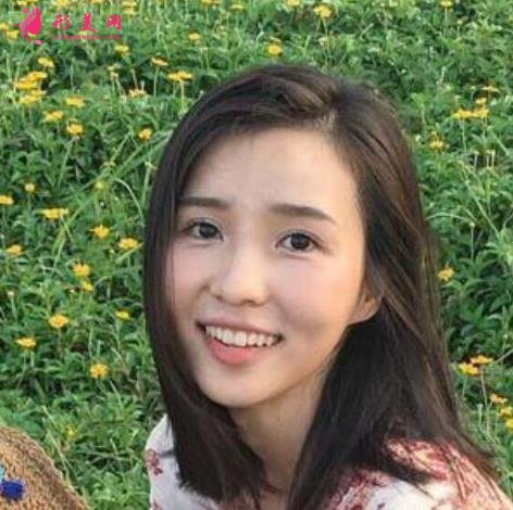 西安唐都醫(yī)院雙眼皮誰(shuí)做得好？專家案例真實(shí)效果反饋！價(jià)格表不要錯(cuò)過(guò)！