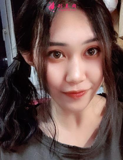 上海伊萊美醫(yī)療美容醫(yī)院做雙眼皮怎么樣？案例真實反饋_整形價格一覽