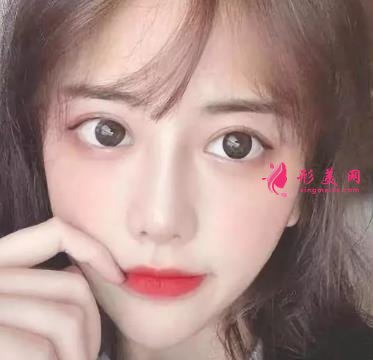 常州一院整形科做鼻子價(jià)格表2021！在分享真實(shí)案例效果圖