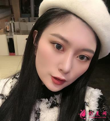 深圳陽光整形醫(yī)院雙眼皮怎么樣？效果好嗎？手術(shù)真實(shí)價格費(fèi)用參考