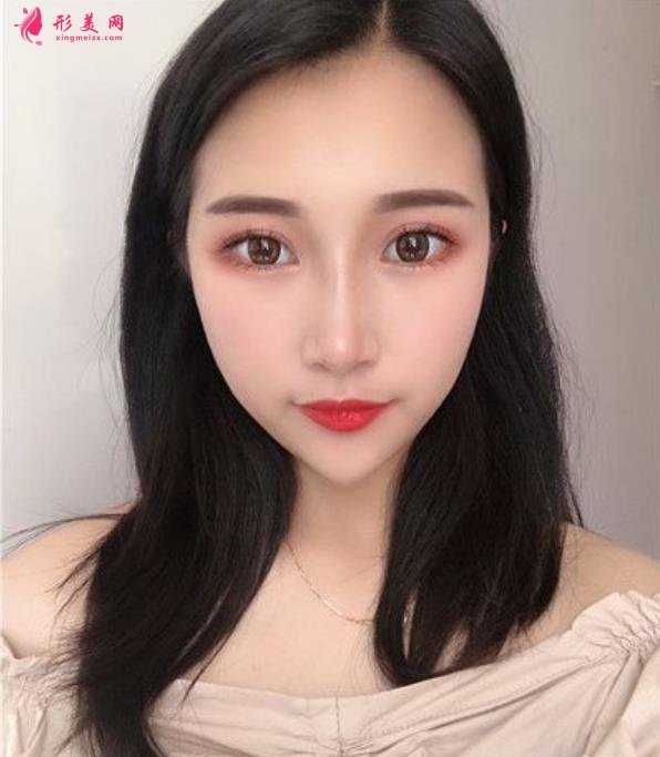 溫州藝星整形美容醫(yī)院做隆鼻怎么樣？好不好？專家案例價格收費一覽