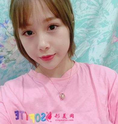 秦皇島市中醫(yī)院醫(yī)學(xué)美容科自體脂肪全臉填充案例一覽！含全新價(jià)格表展示