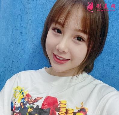 秦皇島市中醫(yī)院醫(yī)學(xué)美容科自體脂肪全臉填充案例一覽！含全新價(jià)格表展示