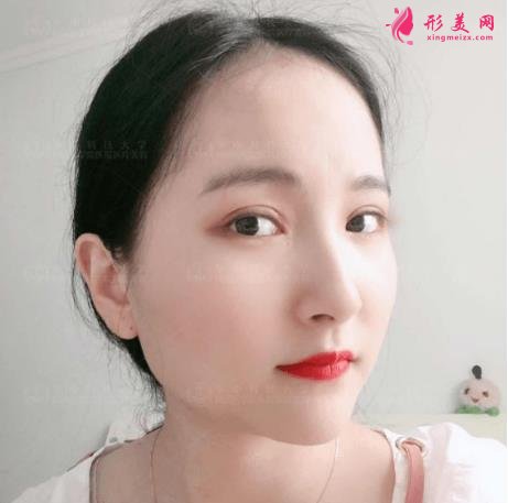 濟(jì)南中心醫(yī)院整形科怎么樣？附雙眼皮價(jià)格披露及案例效果一覽