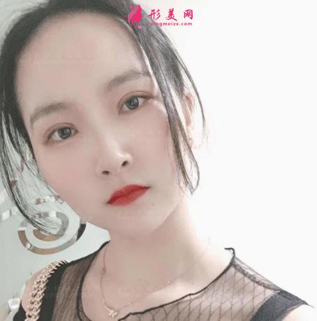 濟(jì)南中心醫(yī)院整形科怎么樣？附雙眼皮價(jià)格披露及案例效果一覽