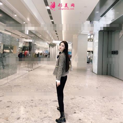 北京純脂吸脂怎么樣？馮慶亮醫(yī)生案例和價格表收費(fèi)標(biāo)準(zhǔn)顯示中~