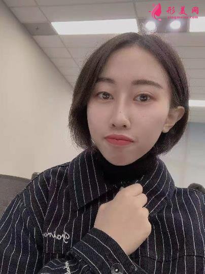 廣州海峽整形醫(yī)院隆鼻好嗎？顧客口碑和精選案例在線查看