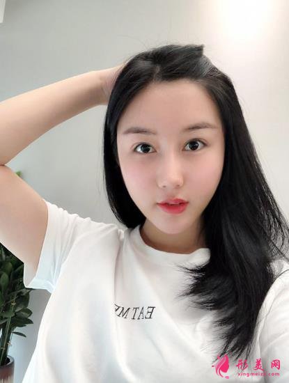 成都排名第一的整容醫(yī)院是誰？對比華西口腔李繼華磨骨案例怎么樣？