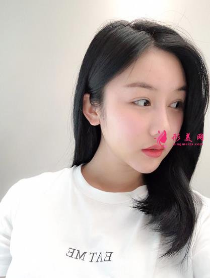 成都排名第一的整容醫(yī)院是誰？對比華西口腔李繼華磨骨案例怎么樣？