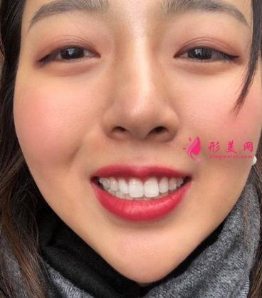 北京友誼醫(yī)院口腔科怎么樣？牙齒矯正案例及價(jià)格表公布啦！