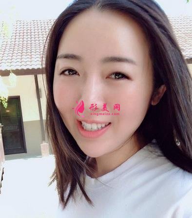 北京友誼醫(yī)院口腔科怎么樣？牙齒矯正案例及價(jià)格表公布啦！