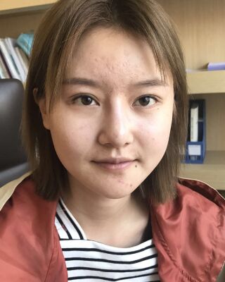 太原美之妍曹立銘面部吸脂瘦臉手術(shù)效果圖