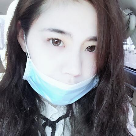 成都高新美極雙眼皮+開眼角案例