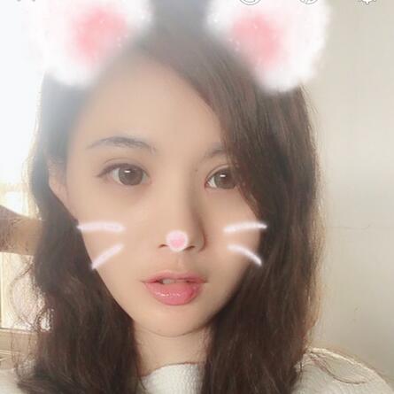 成都高新美極雙眼皮+開眼角案例