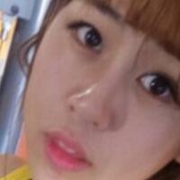 鼻翼縮小手術(shù)對(duì)比圖分享——四川悅好整形