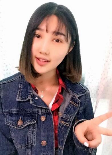 成都玉顏割雙眼皮+開眼角真實案例